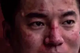 浙江援汉一线医生王楠楠在摘下口罩那一刻，所有人都被震撼到了图片