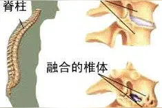 它被称为“不死癌症”，且发病高峰多在20岁~30岁图片