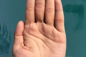 为什么手掌反复脱皮瘙痒？除了湿疹，还和哪些因素有关？图片