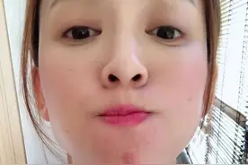 美人计 | 听说戴口罩之后就疯狂冒痘，我来给你诊断诊断图片