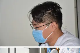 “刺猬”医生头扎银针为患者治疗 网友：发型真美图片