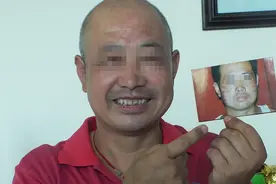 山东淄博：治好白癜风，李士勇蜕变“幸福哥”视频封面