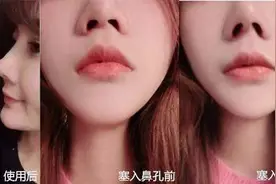 女子用了9块9「美鼻神器」差点丢了命图片