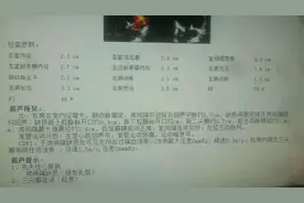 家有先心病娃的家长注意！好多先心病可通过“不开刀”的手术治愈图片