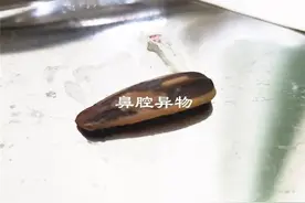 疫情期间宅在家，儿童鼻腔异物要当心图片