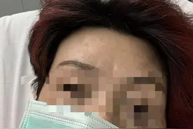 西班牙新冠确诊华人的ICU生死一夜：我只负责呼吸图片