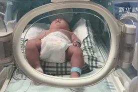 出生时仅巴掌大 四川最小胎龄超早产儿出院视频封面