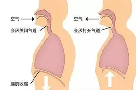 止不住的嗝到底从何而来？这样做可以快速止嗝图片