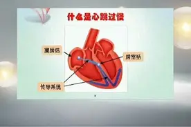 心率过低很危险，积极救心很重要！图片