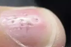 手指甲长这样，是身体出问题了！这6种变化一个比一个危险……图片