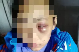 网曝12岁女孩长期遭养母家暴 其母回应：“教育过重”图片