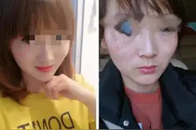 我用斑美娜祛斑后，老公差点和我离婚……图片