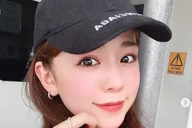 长期带帽子头屑找上门 难道是不洗头惹的祸？图片