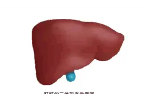 这3种肝病90%都不用治，这几个不被注意的问题反而偷偷要人命图片