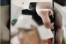 4岁女童遭继母虐打生父也动手打，网友气得发抖：不配为人图片
