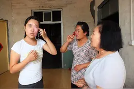 女性白癜风患者的20、30、40岁图片