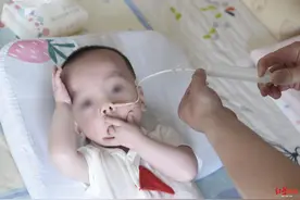 儿子不到1岁六进六出ICU，这位妈妈自学医护知识变身“超人妈妈”图片