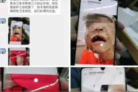 黑龙江4岁女童被虐事件：邻居曾听到连续打骂四五个小时，生父称“她不听话”图片