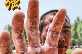 遇见，最美的双手！图片