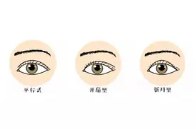 韩式、日式、欧式……双眼皮术式怎么选，眼睛才灵动有神？图片