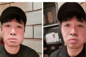 俞灏明“脸肿如瓜”网友留言：神似刘翔和潘粤明图片
