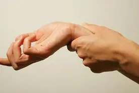 “鼠标手”能放任不管吗？预防方法教给你图片