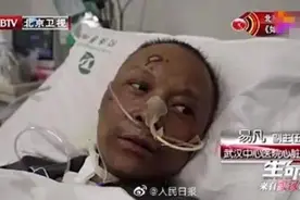 欣慰｜易凡医生出院！曾因“面容变黑”备受关注图片