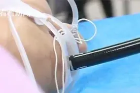 少年误吞牙签 爷爷“念咒语”让他又吞了截筷子……图片