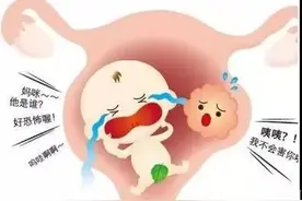 真要命！胎儿旁边竟是10厘米肿瘤，医生果断这样操作……图片