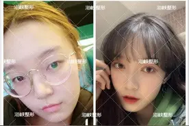 济南海峡整形：为什么你明明五官很漂亮，但就是不好看？图片