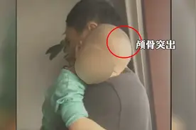 母婴店竟将固体饮料当成奶粉卖？这些孩子喝成了“大头娃娃”图片