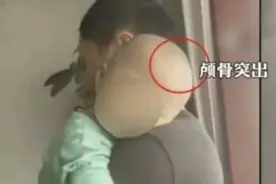 监管缺失，“大头娃娃”重现，链条式作恶丧失基本人性，需全面追责图片
