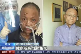 “黑脸”医生回家后陪女儿上网课，他说一家人在一起就很开心图片