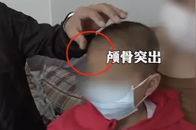 官方介入！多名幼儿喝“假奶粉”长成大头娃娃 家长：竟是饮料图片