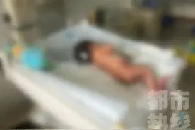 发病率三万五千分之一！男婴竟长出“球形尾巴”，出生6小时后医生为他手术图片