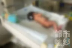 发病率三万五千分之一！男婴竟长出“球形尾巴”，出生6小时后医生为他手术图片