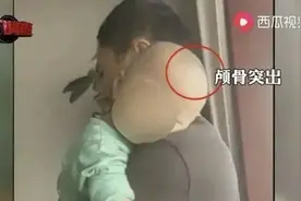 “郴州大头娃娃”涉事蛋白粉公司回应称产品合格，家长发声图片