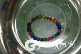 惊险！贵州医生连续在两名儿童体内取出41颗磁力珠！一名孩子还出现胃肠穿孔……图片