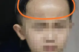 “大头娃娃”事件调查：男童快4岁仍不会说话 家长：孩子喝一年多才知道“奶粉”竟是饮料图片
