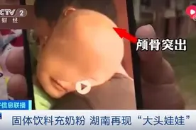 痛心！湖南出现“大头娃娃”，患病孩子都喝了这种“特殊奶粉”图片