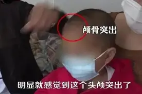 一年不到，两起“大头娃娃”事件，谁在鼓动家长买“假奶粉”？人民日报评论：真相必须揭开图片