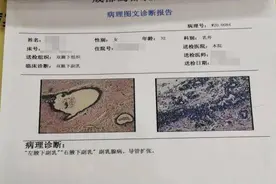 吊带衫、连衣裙因为它不敢穿？副乳到底是啥？出现了应该怎么办？图片