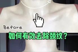 女人都敌不过显老5岁的颈纹！脖子上的“沟沟壑壑”该怎么办？图片