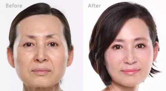 女性长期喝胶原蛋白的坏处 2026年女人吃什么补胶原蛋白皮肤好＂,＂n