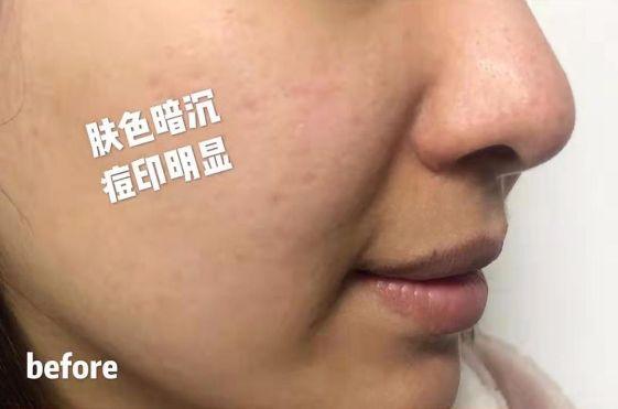 女性长期喝胶原蛋白的坏处 2026年女人吃什么补胶原蛋白皮肤好＂,＂n