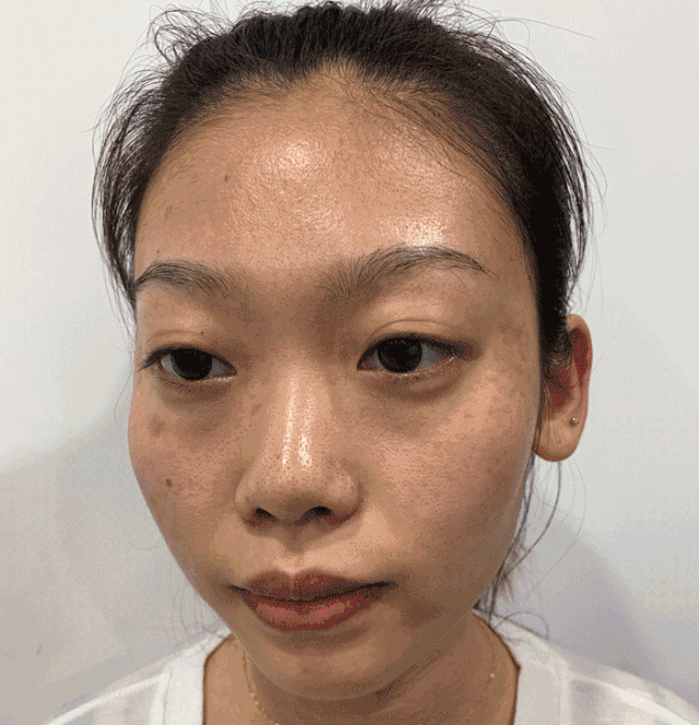 女性长期喝胶原蛋白的坏处 2026年女人吃什么补胶原蛋白皮肤好＂,＂n