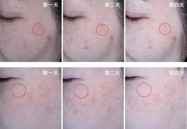 女性长期喝胶原蛋白的坏处 2026年女人吃什么补胶原蛋白皮肤好＂,＂n