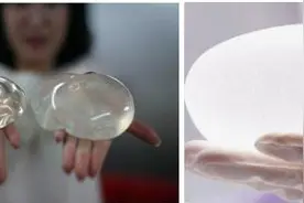 假体隆胸价格大概是多少？图片