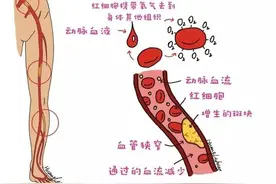 “走走停停”，是双腿的呐喊图片
