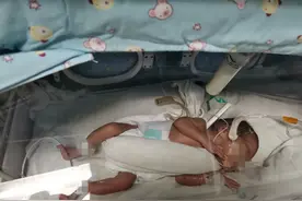 罕见！三个胎儿分3次“出生”，广州妈妈两个多月艰难保住两胎图片